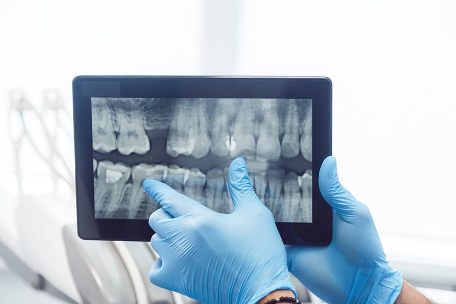 Reviewing X-Ray on Monitor