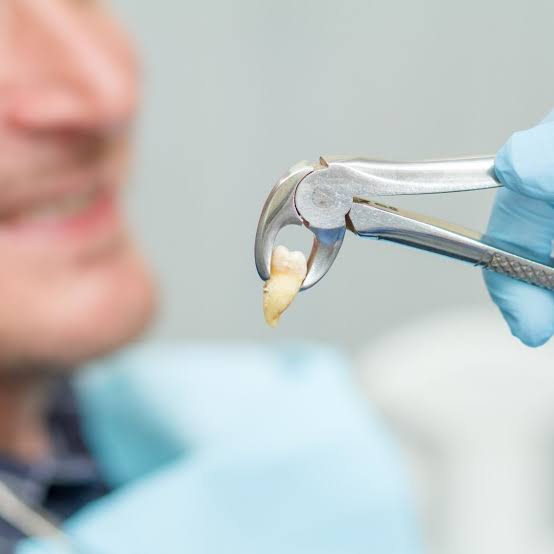 Gentle Tooth Extraction Care at Niko Dental